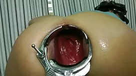 Голям задник абанос  ...